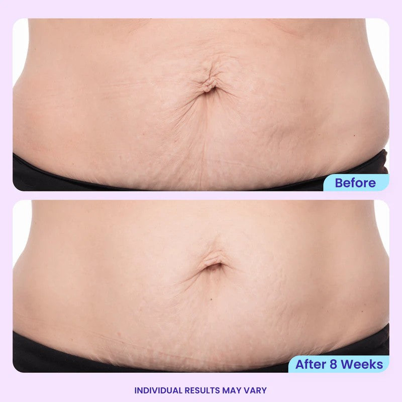 <p><strong>See Why Everyone Loves Body Coverage Perfector</strong></p>