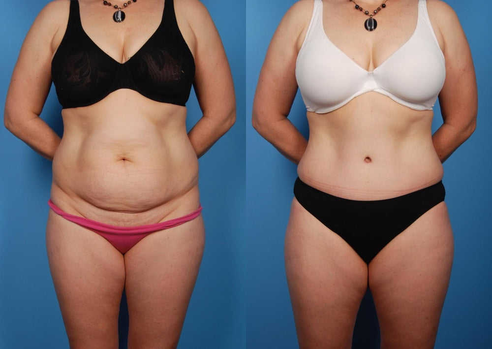 <p><strong>See Why Everyone Loves Body Coverage Perfector</strong></p>