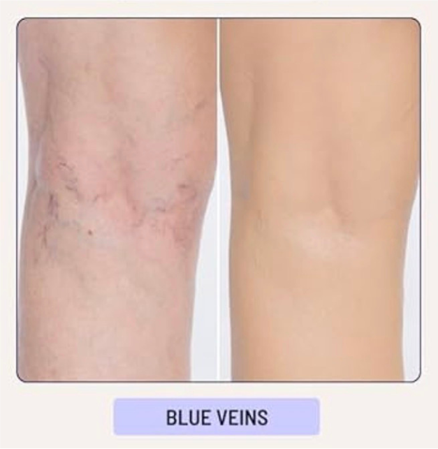 <p><strong>See Why Everyone Loves Body Coverage Perfector</strong></p>