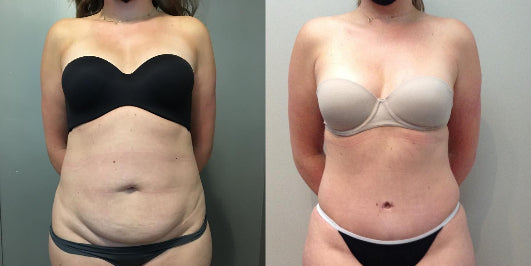 <p><strong>See Why Everyone Loves Body Coverage Perfector</strong></p>