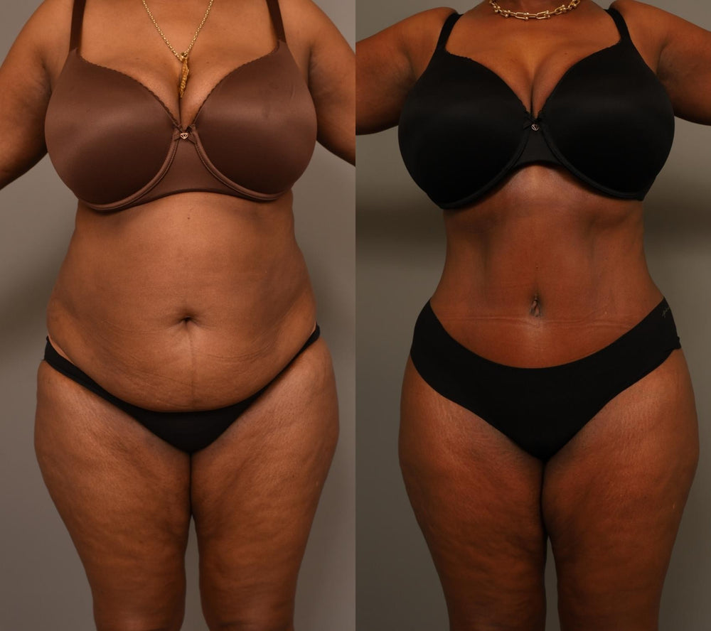 <p><strong>See Why Everyone Loves Body Coverage Perfector</strong></p>