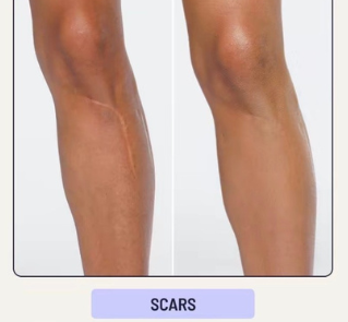 <p><strong>See Why Everyone Loves Body Coverage Perfector</strong></p>