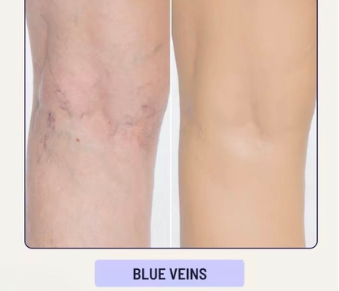 <p><strong>See Why Everyone Loves Body Coverage Perfector</strong></p>