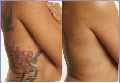 <p><strong>See Why Everyone Loves Body Coverage Perfector</strong></p>