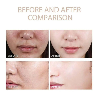 Korean Hydrating Facial Serum for Women - Pore Minimizer Anti-Aging Moisturizing Whitening Oil-Control Blackhead Removal Liquid