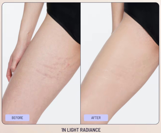 <p><strong>See Why Everyone Loves Body Coverage Perfector</strong></p>