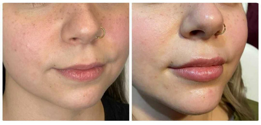 <p><strong>See Why Everyone Loves PDRN Pink Collagen</strong></p>