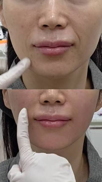 <p><strong>See Why Everyone Loves PDRN Pink Collagen</strong></p>