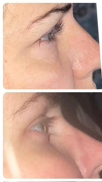 <p><strong>See Why Everyone Loves PDRN Pink Collagen</strong></p>