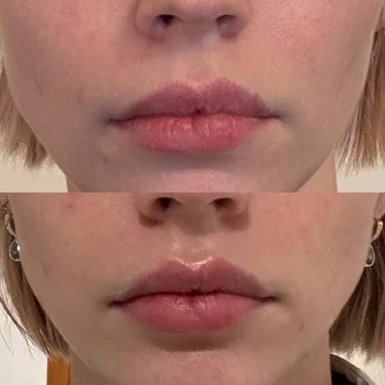 <p><strong>See Why Everyone Loves PDRN Pink Collagen</strong></p>