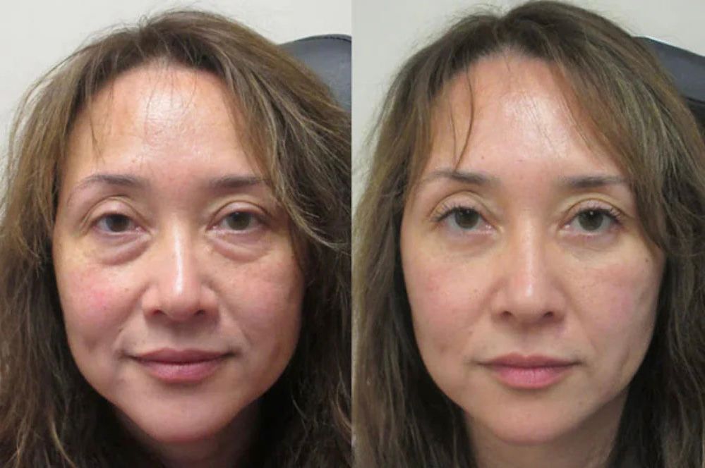 <p><strong>See Why Everyone Loves PDRN Pink Collagen</strong></p>