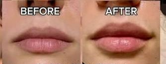 <p><strong>See Why Everyone Loves PDRN Pink Collagen</strong></p>