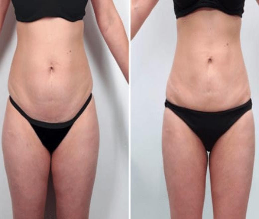 <p><strong>See Why Everyone Loves Body Coverage Perfector</strong></p>